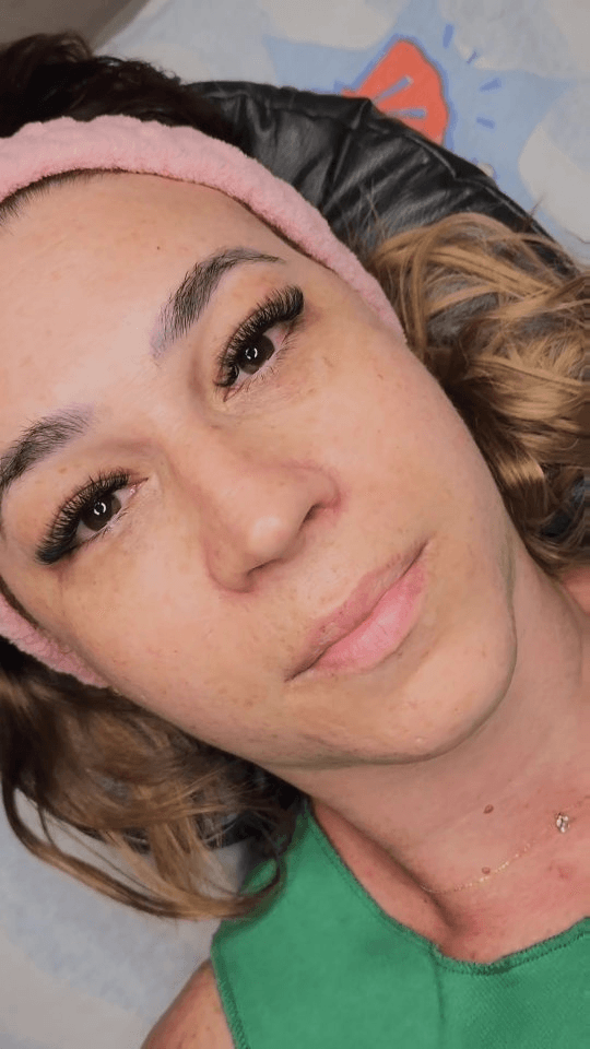 Antes e depois