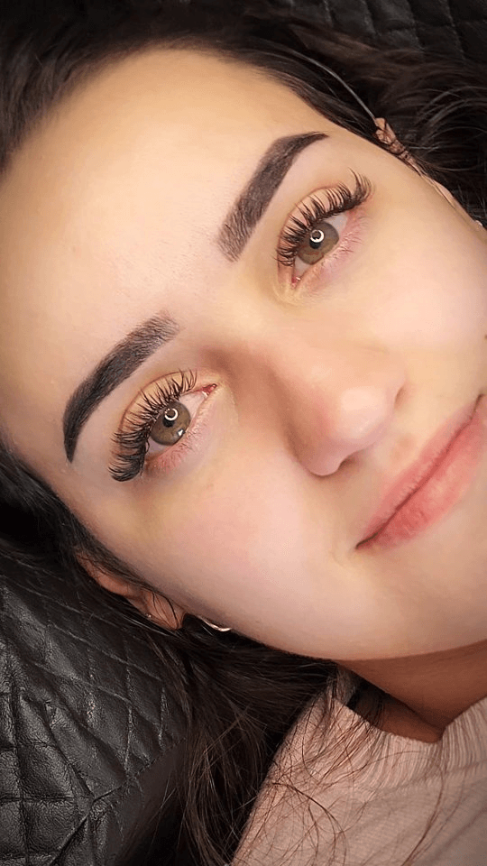 Antes e depois