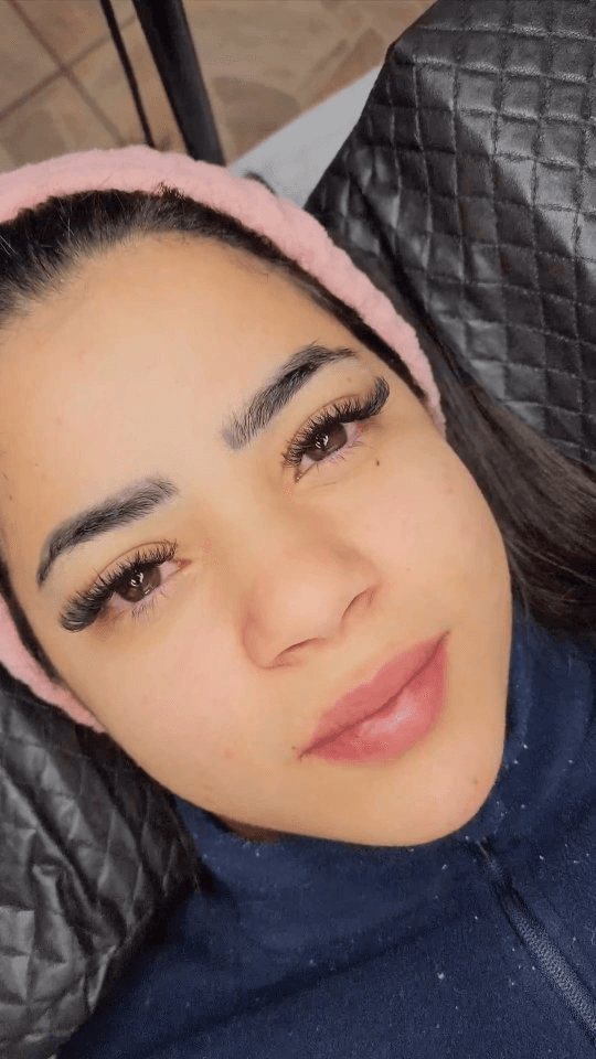 Antes e depois